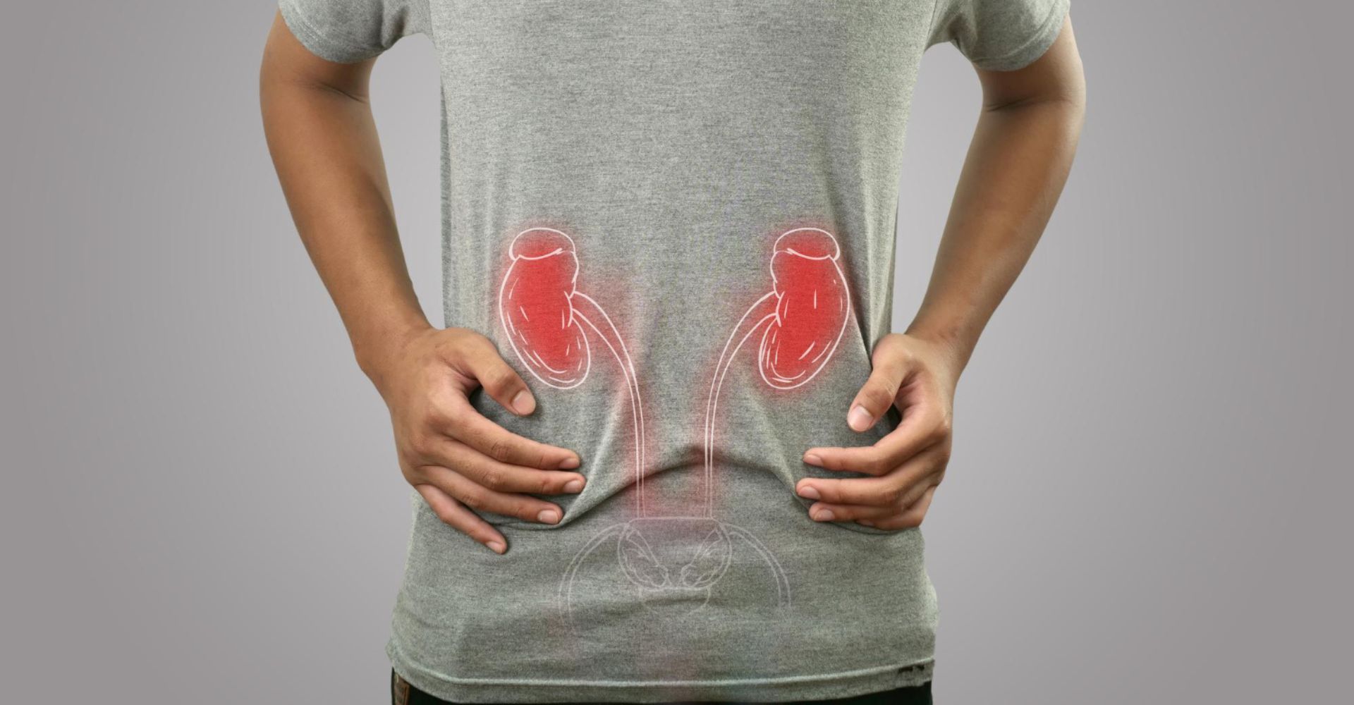 Can Kidney Stones Cause Kidney Failure?